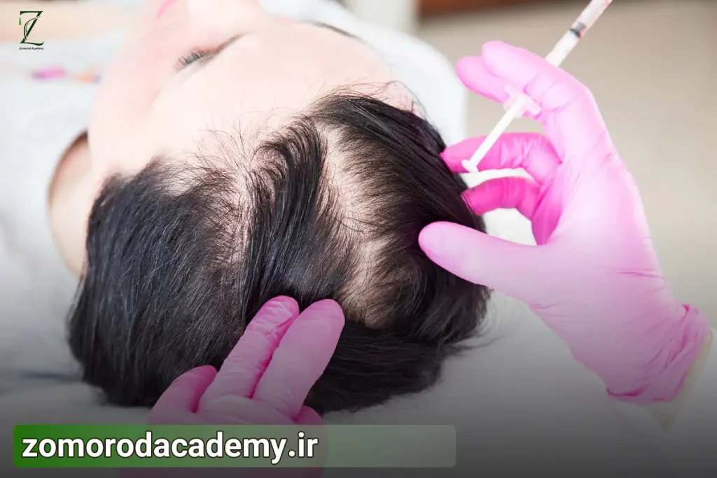 فیلر مو برای چه افرادی مناسب است؟