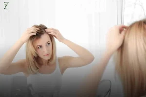 هایلایت مو چیست؟ انواع روش های هایلایت مو